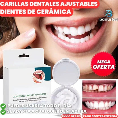 🚨OFERTA 2x1🚨: Carillas Dentales Snap On Smile🦷 | Luce una Sonrisa Soñada