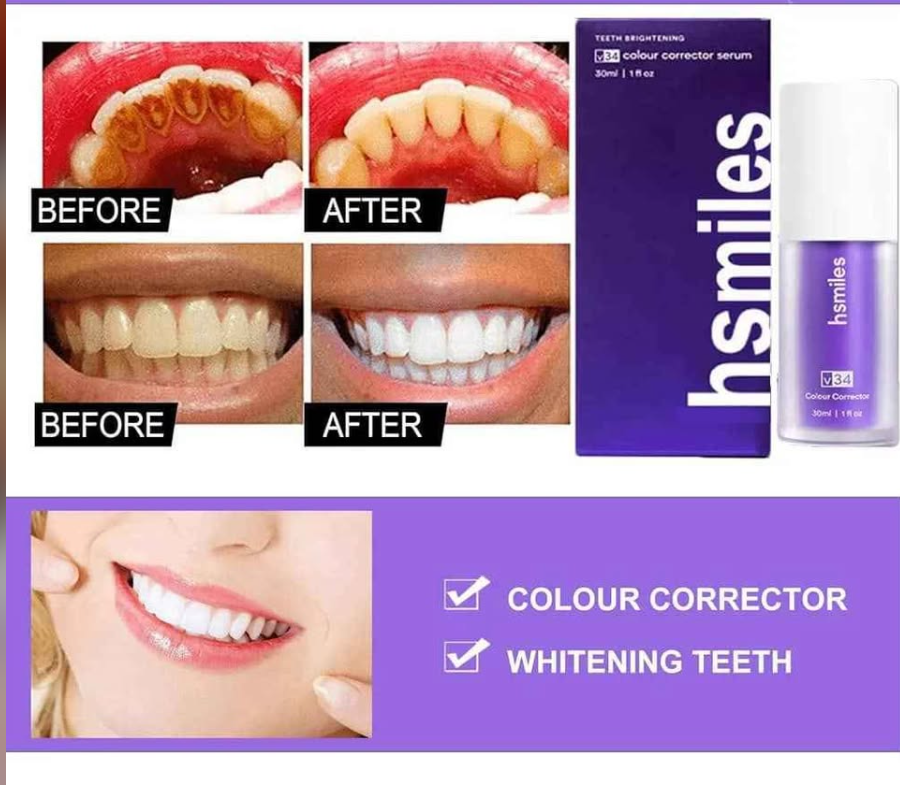 🛒blanchisseur de dent: mousse d'entretient dentaire