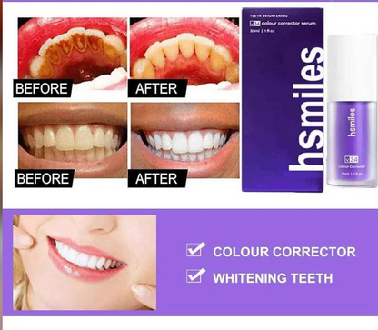 🛒blanchisseur de dent: mousse d'entretient dentaire