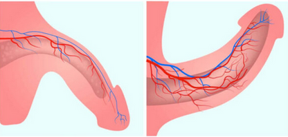 thé prostate à titre curatif et préventif