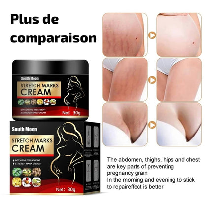 South Moon Stretch Marks Cream – Traitement intensif anti-vergetures
