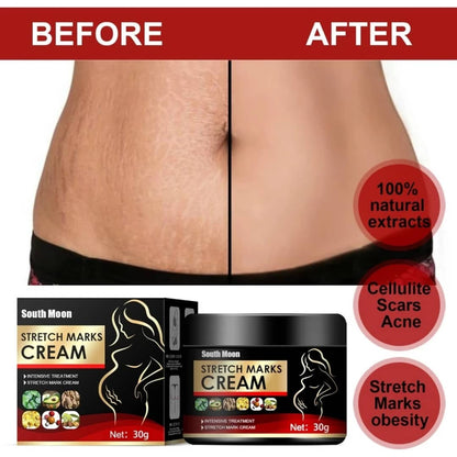 South Moon Stretch Marks Cream – Traitement intensif anti-vergetures