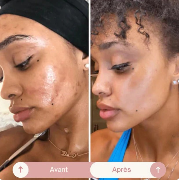 Masque de Visage en collagène. Lisse, hydrate et raffermit le visage.