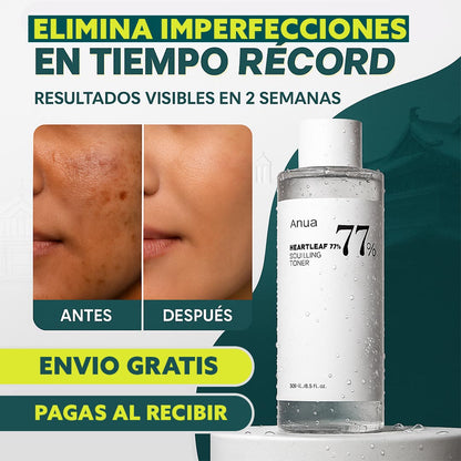 ANUA Heartleaf 77% Tónico Revitalizante Coreano