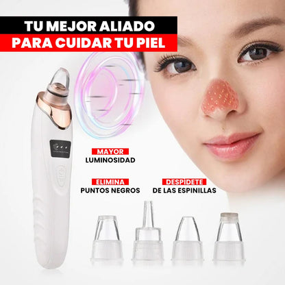 Extractor de Espinillas y Puntos Negros + Guía Digital GRATIS!